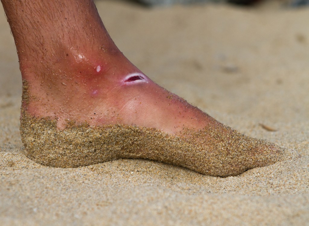 Ode to the&nbsp;Pains